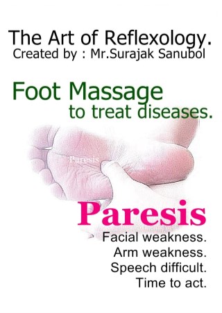 paresis-หน้าปก-ookbee