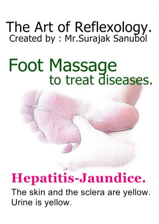 hepatitis-jaundice-หน้าปก-ookbee