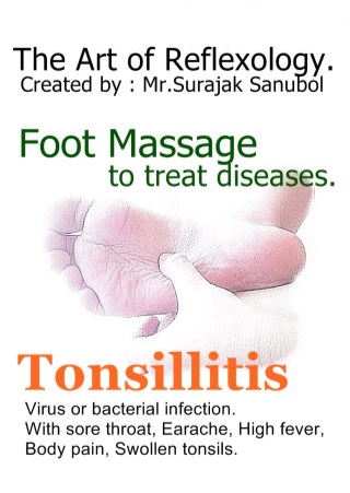 tonsillitis-หน้าปก-ookbee