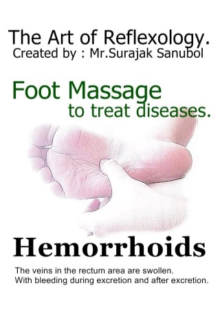 hemorrhoids-หน้าปก-ookbee