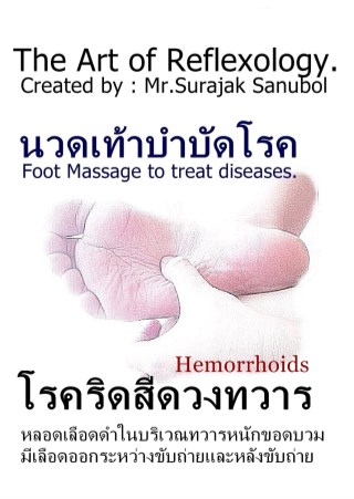 โรคริดสีดวงทวาร-หน้าปก-ookbee